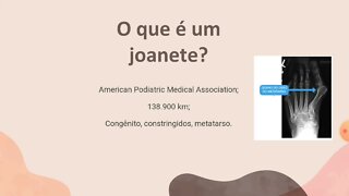 [pt. 2] Joanetes: causas, sintomas e tratamentos