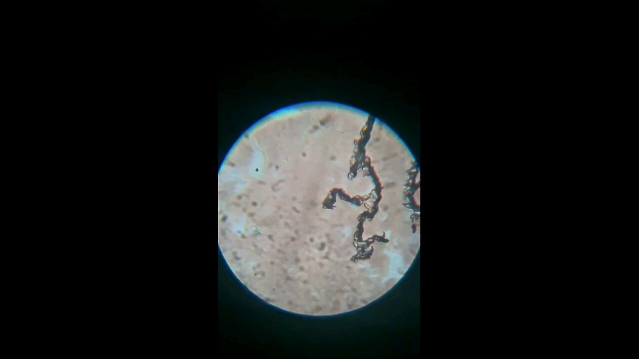 Watch this black substance grow in my blood. Graphene ?