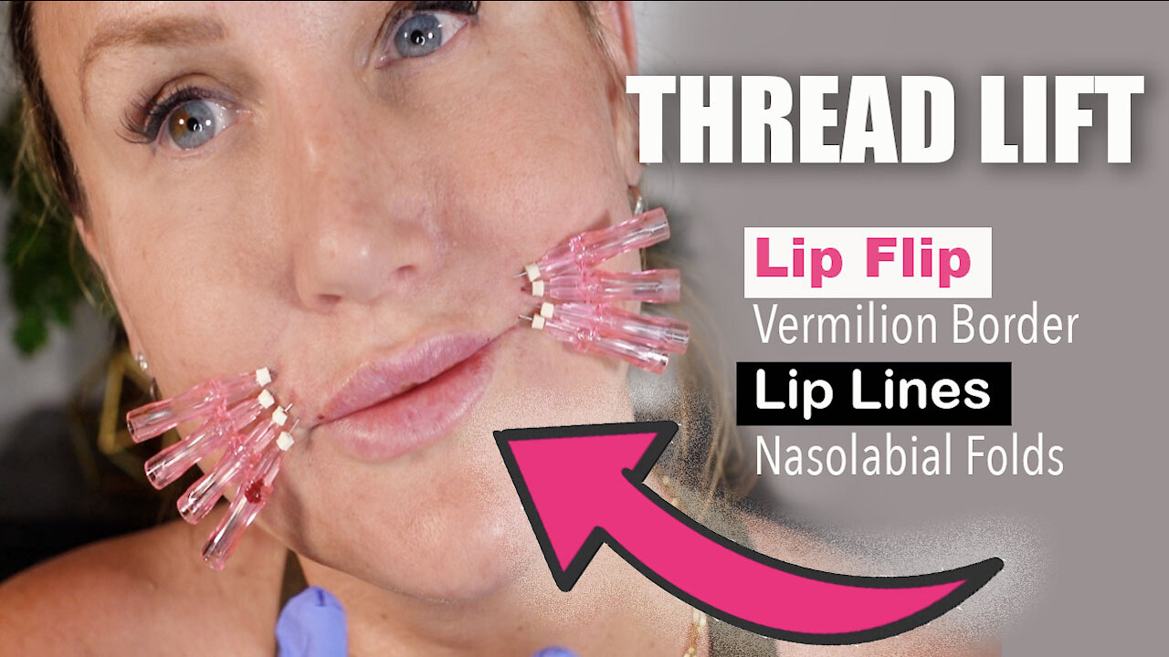 Lip & Mouth Threads | Gorgeously Aging