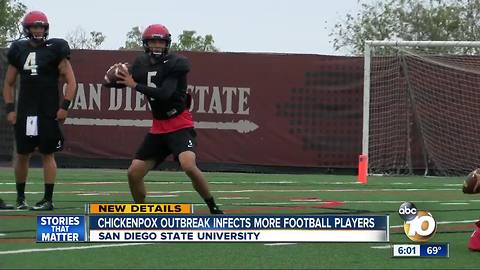 Chickenpox outbreak infects more football players