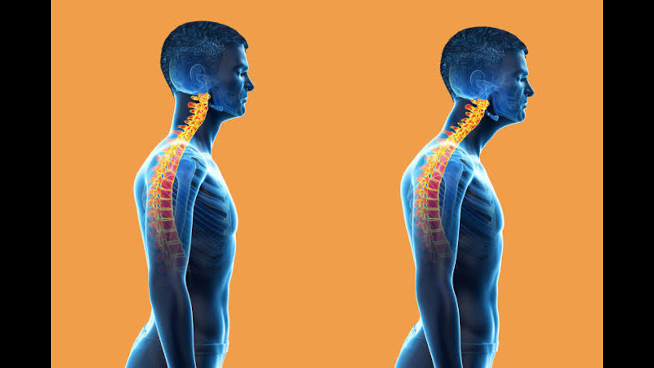 Stretches to Improve Forward Head Posture