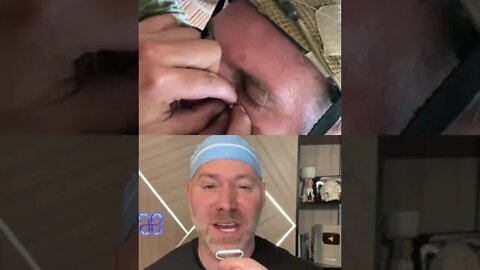 Airsoft Pellet Stuck Under His Eye 👁 #shorts