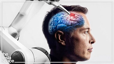 The 2022 Neuralink Update Is Here!