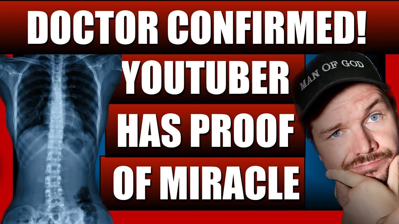 Doctor Confirms Proof Of A Miracle! Is God Real Today? Christians React #reaction