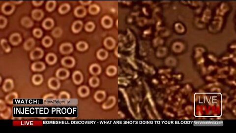 What COVID Injections Do To Your BLOOD Doctor Releases Horrific Findings