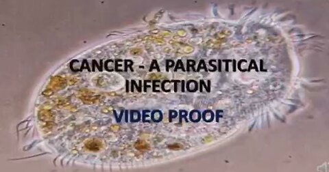 Cancer a microscopic parasitical infection,