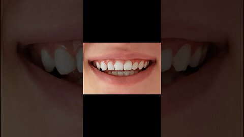 How To Whiten Teeth In Photoshop #mcd #mcddesigner #shorts #short #photoshop_tutorial