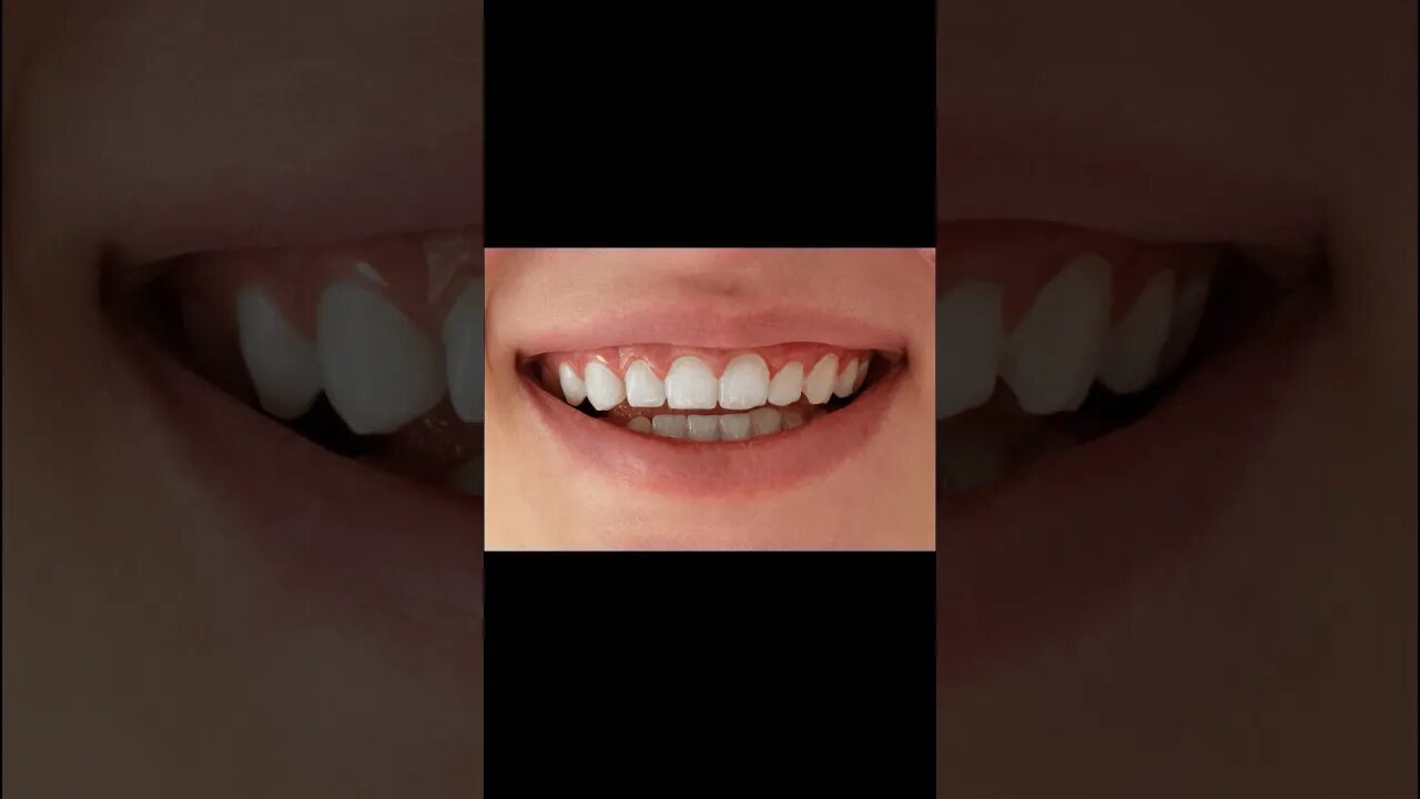 How To Whiten Teeth In Photoshop #mcd #mcddesigner #shorts #short #photoshop_tutorial