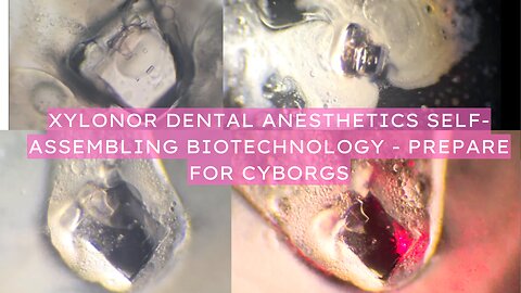 XYLONOR DENTAL ANESTHETICS SELF-ASSEMBLING BIOTECHNOLOGY - PREPARE FOR CYBORGS