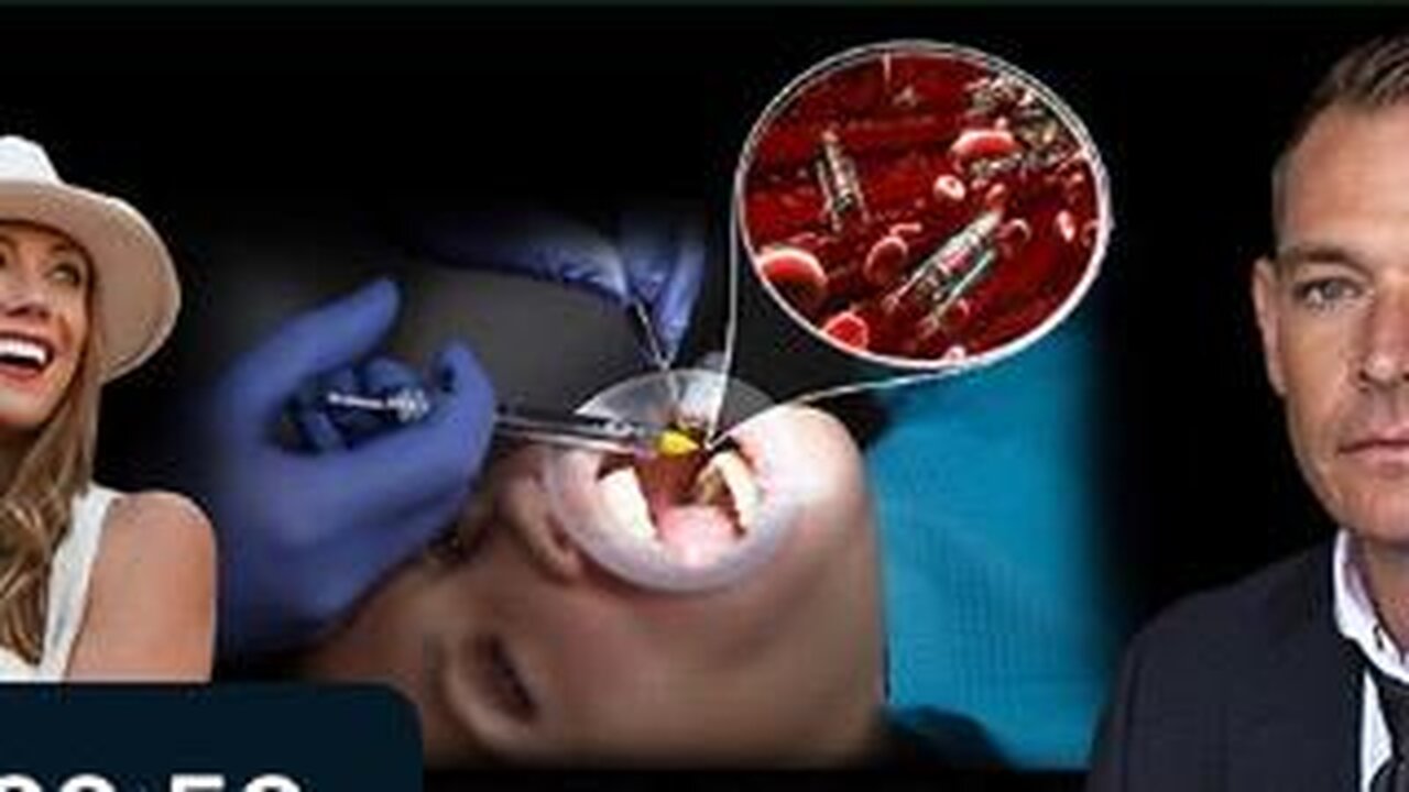 Shock Claim : Dental Anesthetic Poisoned with nano tech:Graphene Oxide & Hydro Gel used in dentistry