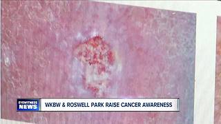 Skin Cancer Roswell