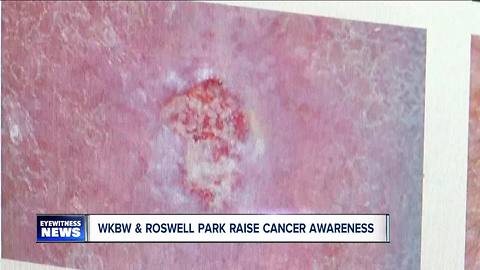 Skin Cancer Roswell