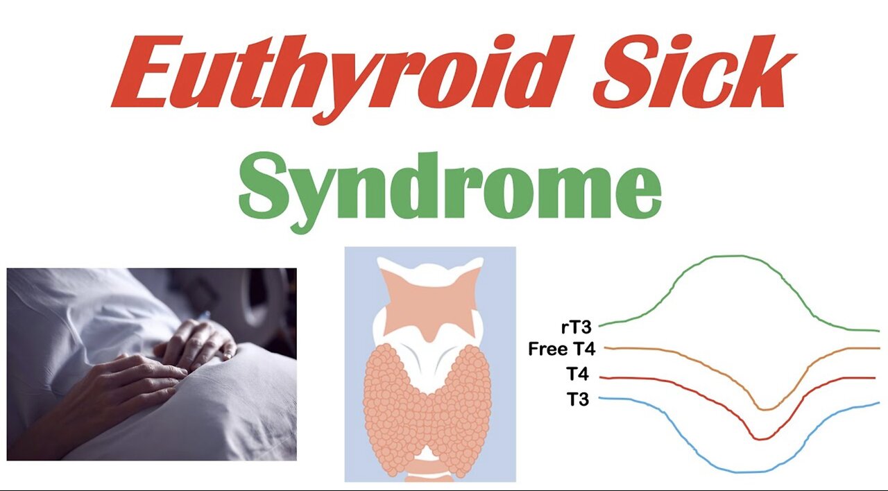 Euthyroid Sick Syndrome (Nonthyroidal Illness Syndrome) Causes, Symptoms, Diagnosis, Treatment
