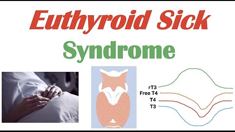 Euthyroid Sick Syndrome (Nonthyroidal Illness Syndrome) Causes, Symptoms, Diagnosis, Treatment