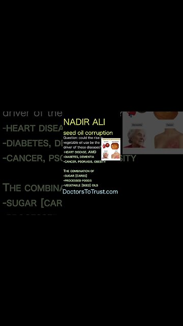 Nadir Ali. Rise in vegetable oil be the driver of these diseases?-heart, AMD-diabetes, dementia