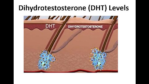 DHT - Dihydrotestosterone - How to naturally balance your hormones