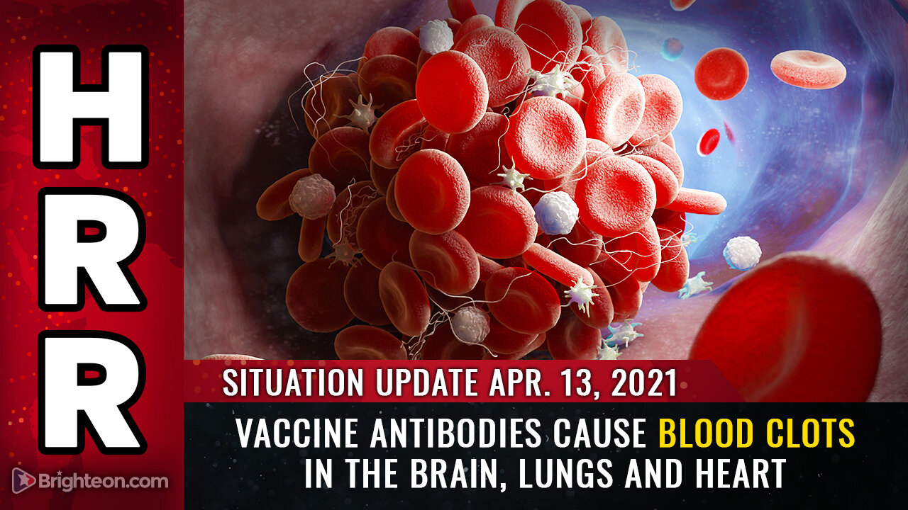 Situation Update, 04/13/2021 - Vaccine antibodies CAUSE blood clots in the brain, lungs and heart