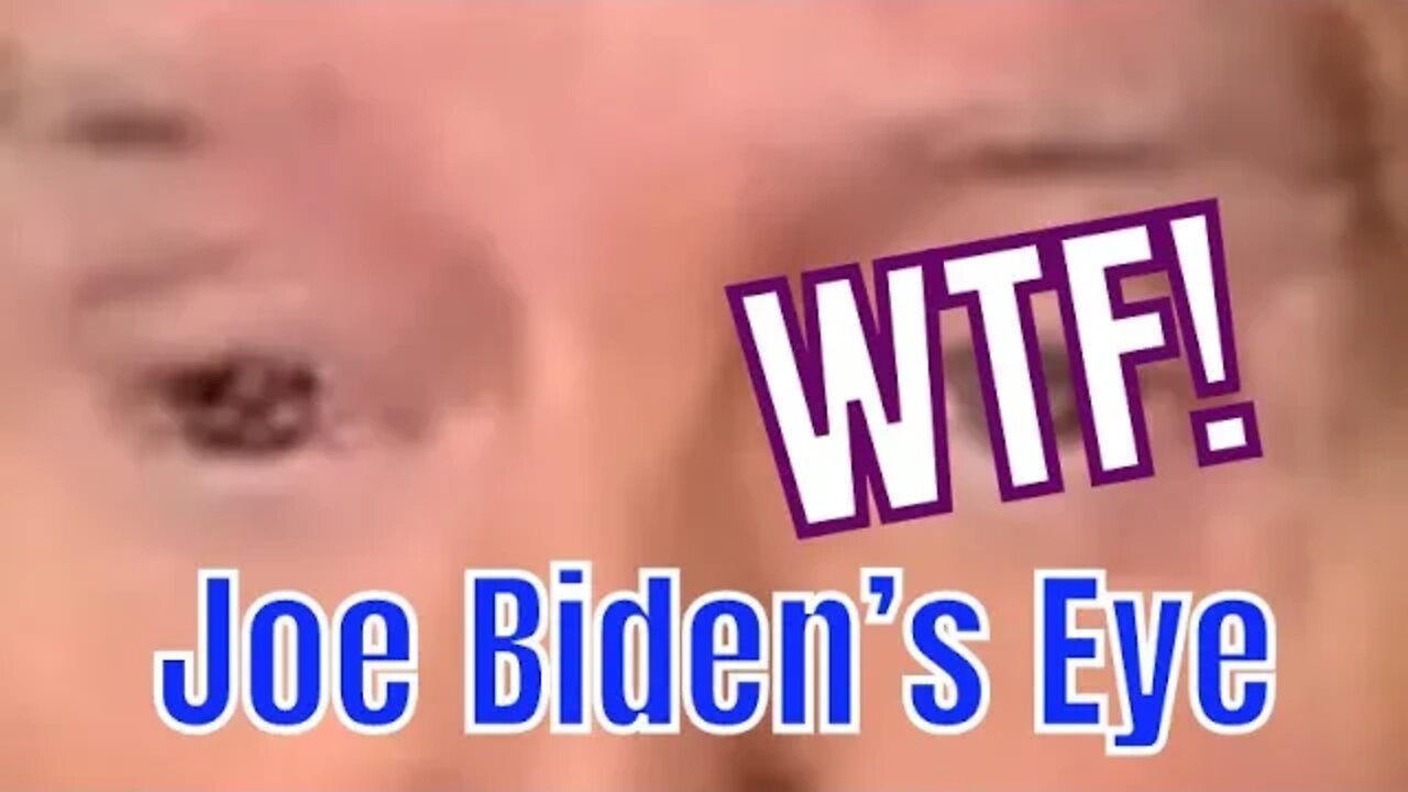 HOLY SH!T - JOE’S EYEBALL IS PHUQED!