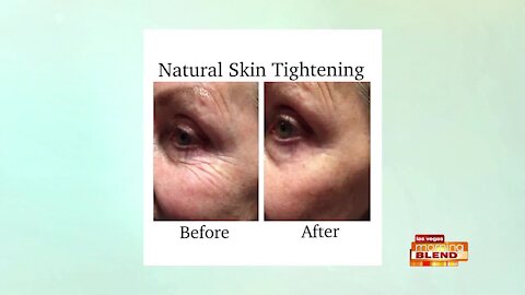 Tighten Skin Without Surgery