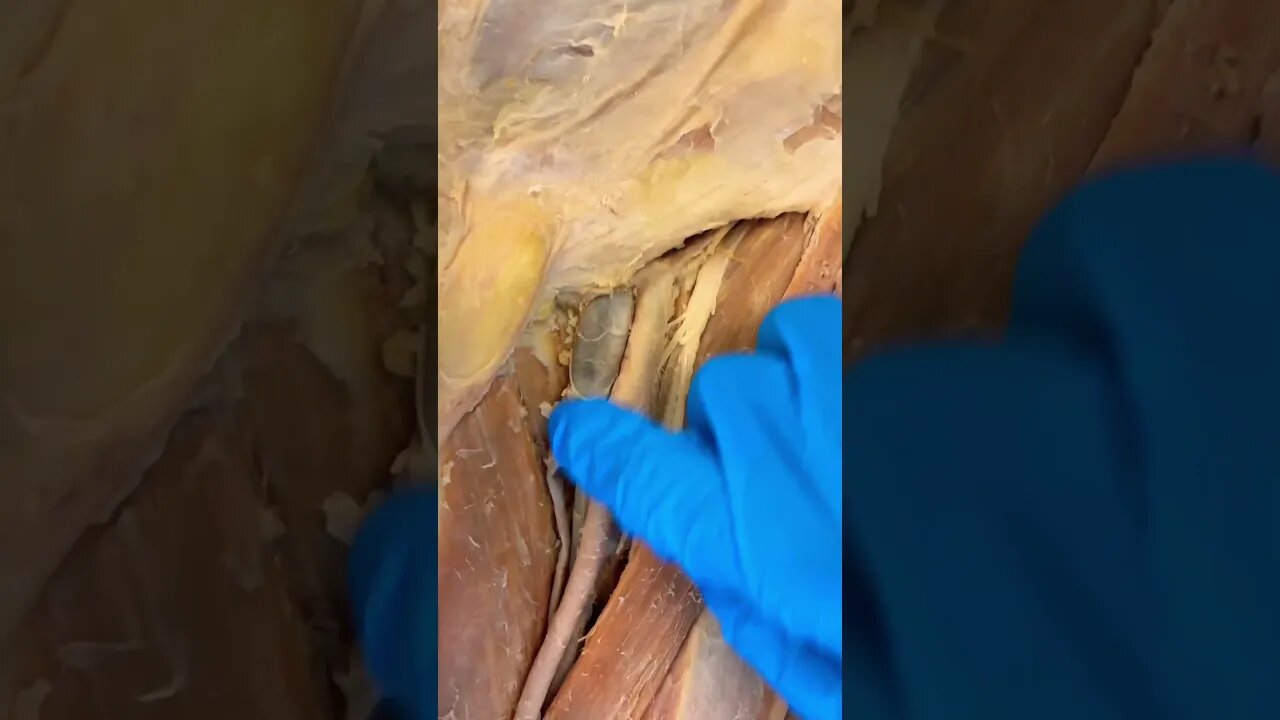 Look How Cool These Blood Vessels Are!