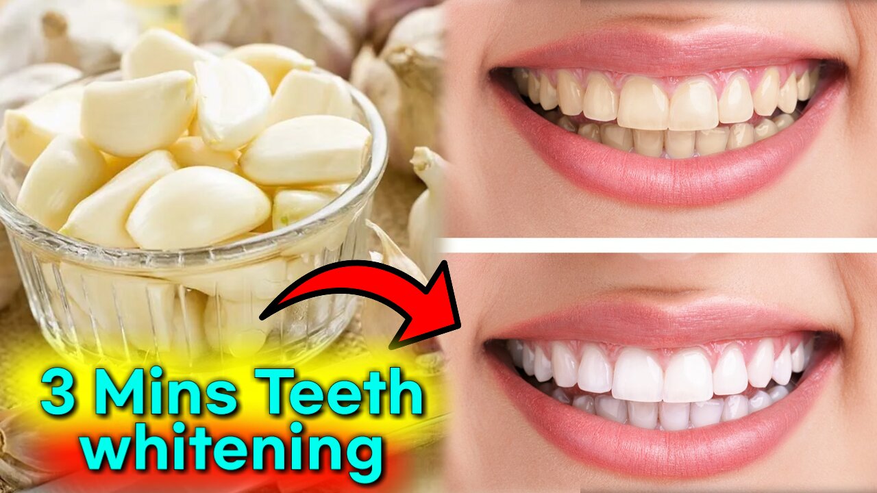 Just 3 mins Teeth whitening tips video in Tamil