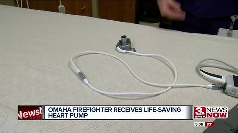 Omaha firefighter receives life-saving heart pump