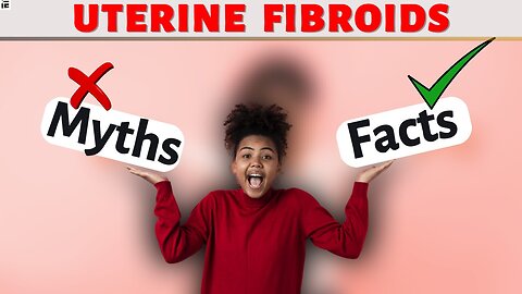 6 Misconceptions on fibroids – Myths & Facts