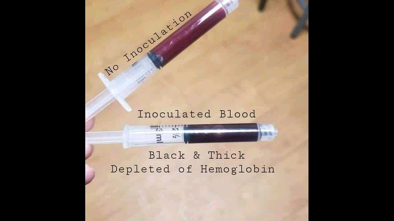 Blood Donation Centers No Longer Accepted Covid Vaxxed Blood