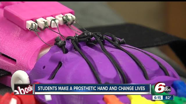 4-year-old girl gets prosthetic hand because of engineering class a Cathedral High School