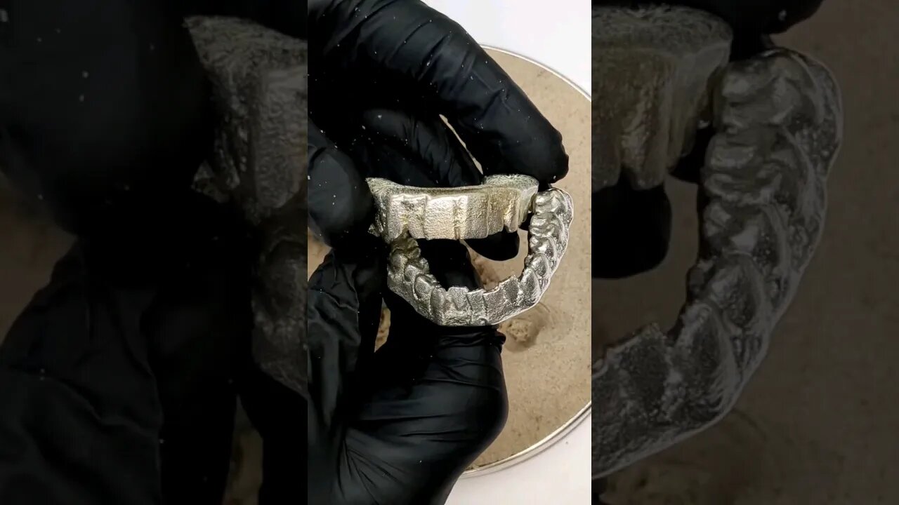 Casting Silver Teeth