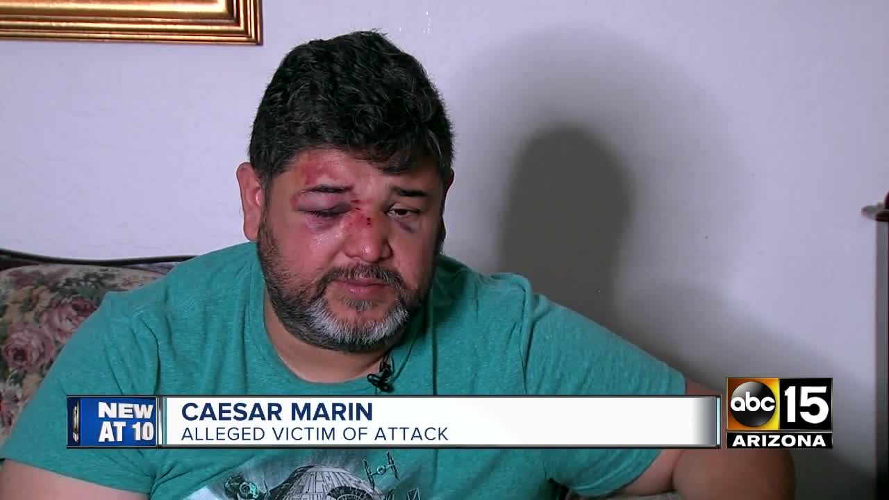 Phoenix man attacked in possible hate crime