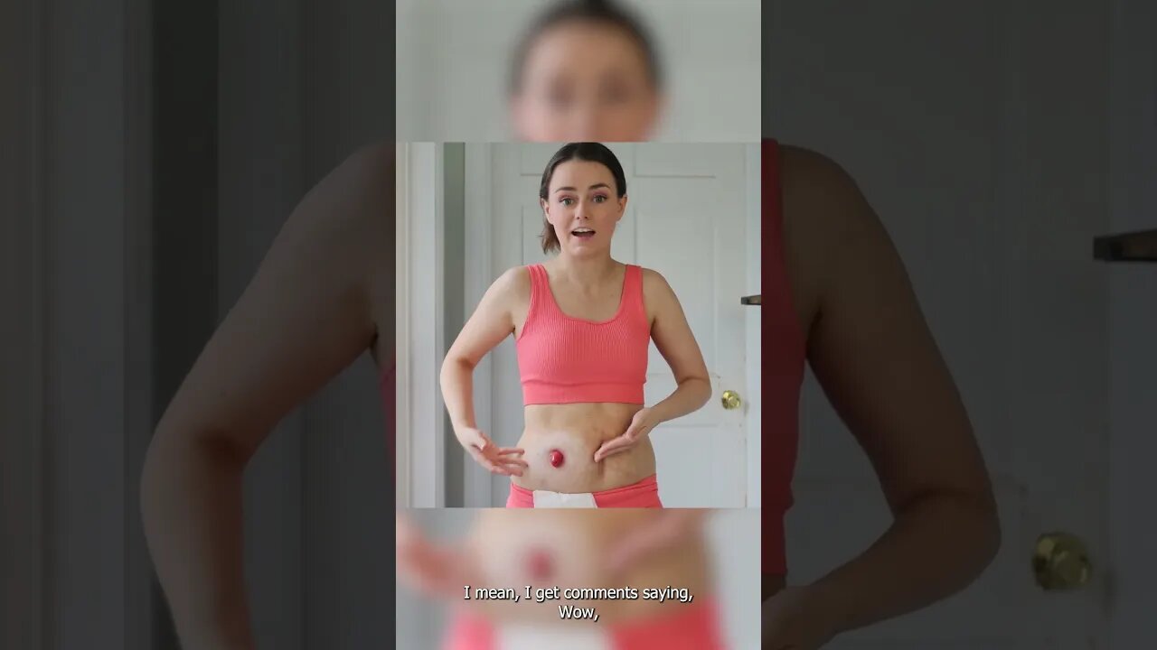 Peristomal Skin Irritation Can Be COMPLEX! | #shorts | Let's Talk IBD