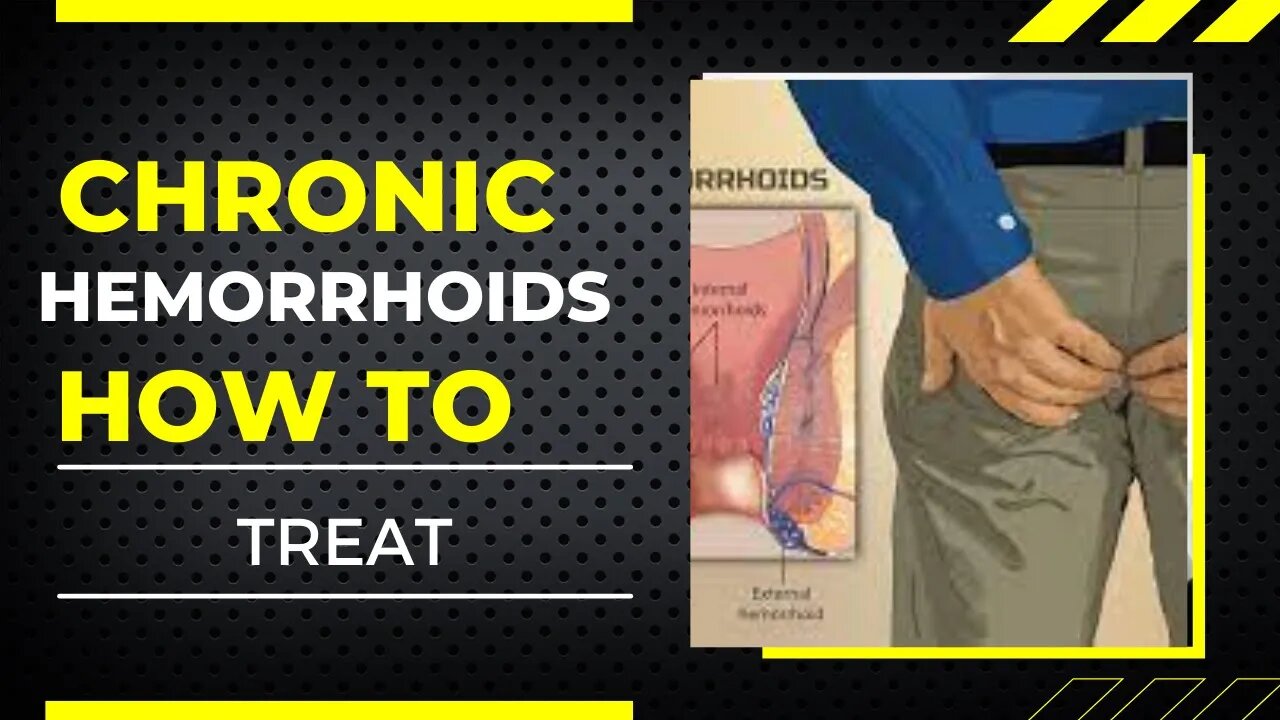 How To Get Rid Of Chronic Hemorrhoids | Chronic Hemorrhoids Symptoms | Hem Healer