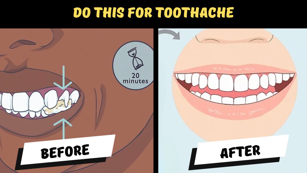 Instant home remedy of toothache