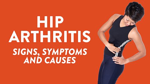 Hip arthritis: Signs, symptoms and causes