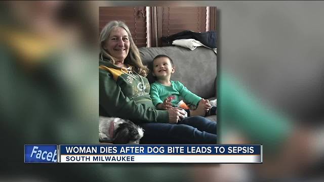 Wisconsin woman's death attributed to infection from a dog lick