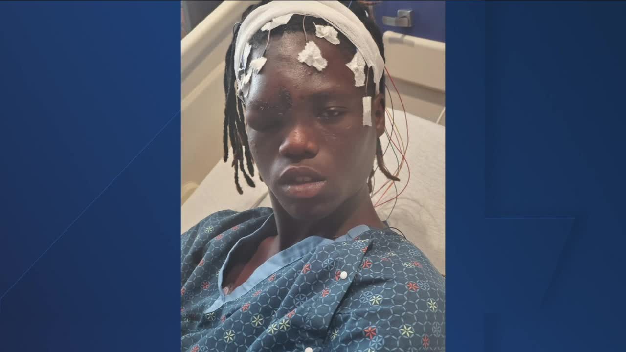 Mom speaks after son was shot with rubber bullet following unrest