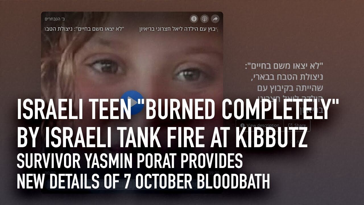 Israeli teen ”burned completely” by Israeli tank fire at kibbutz