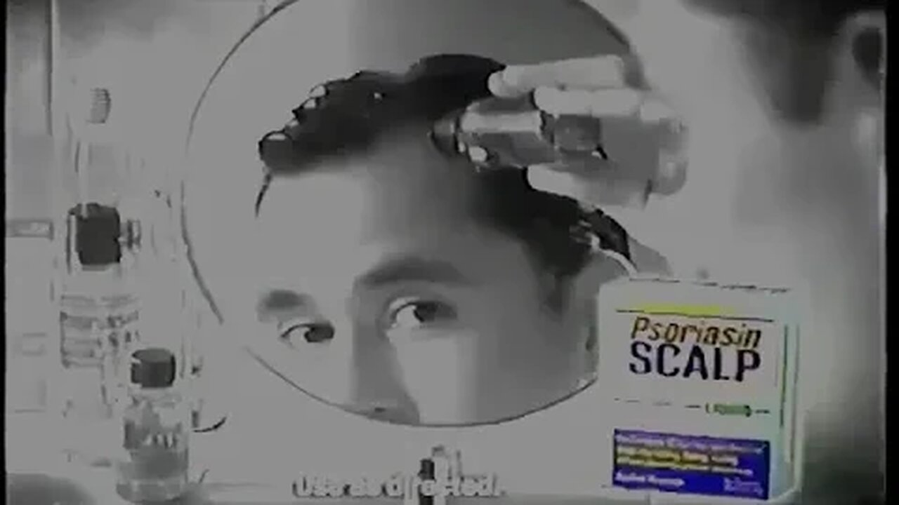 "My Scalp Itches" 2002 Psoriasin Shampoo Commercial