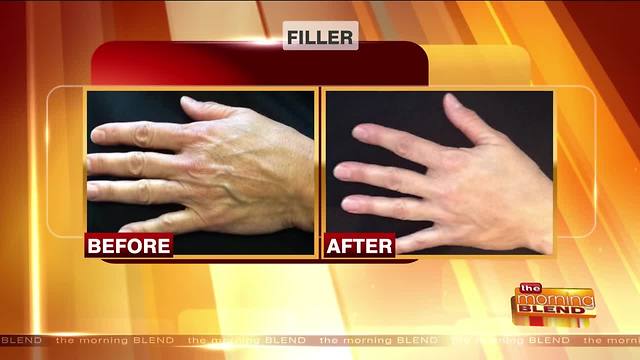 Options for Reducing Aging Signs on Your Hands