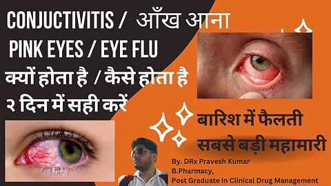 CONJUCTIVITIS | SYMPTOMS | TREATMENT | आँख चिपकने का इलाज | EYE INFECTION | पहले दिन से आराम शुरू
