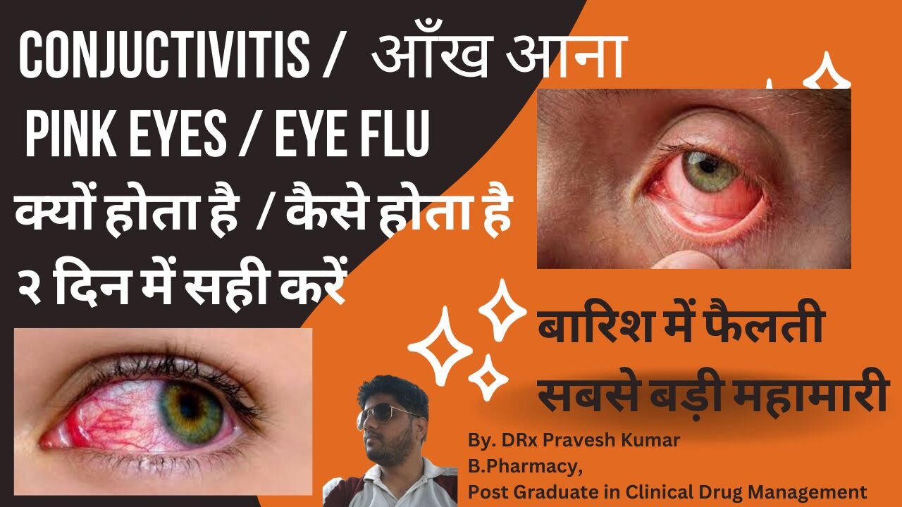 CONJUCTIVITIS | SYMPTOMS | TREATMENT | आँख चिपकने का इलाज | EYE INFECTION | पहले दिन से आराम शुरू
