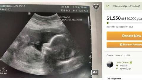 Brain Dead Woman to Give Birth at Saint Alphonsus in Boise