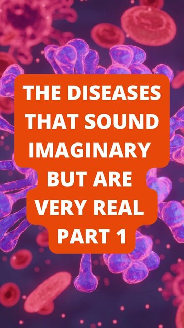Part 1: The Diseases That Sound Imaginary, But Are Very Real