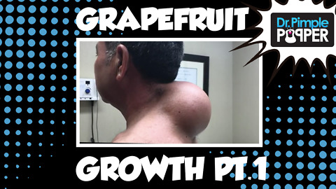 Grapefruit-sized Growth: Part 1- The Punch