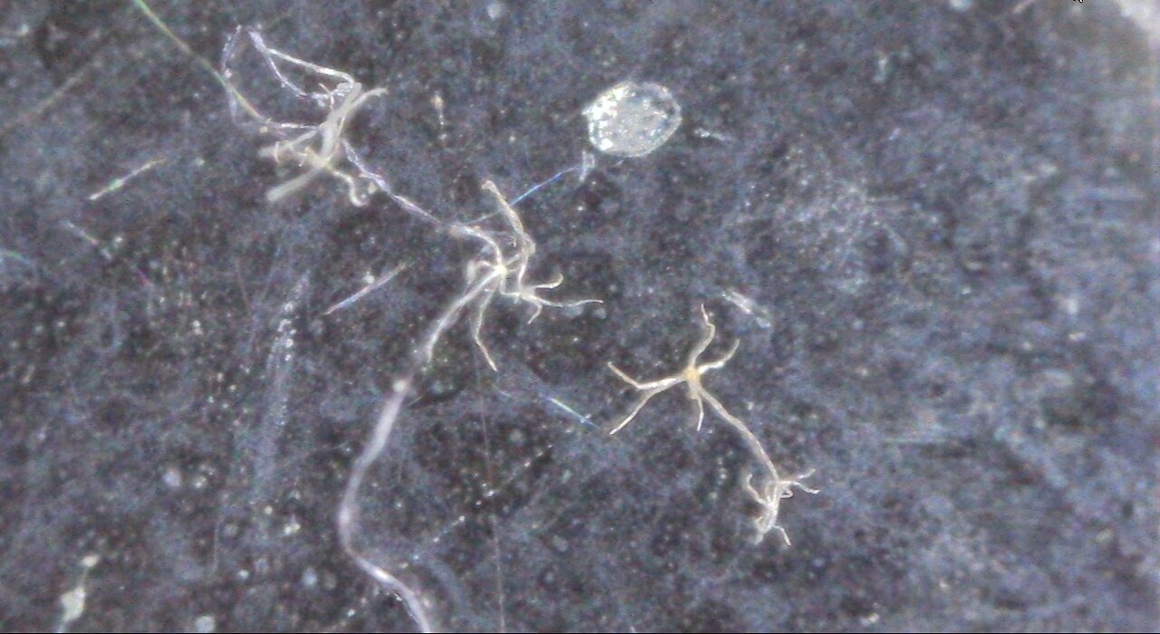 Hydra in My Household Dust