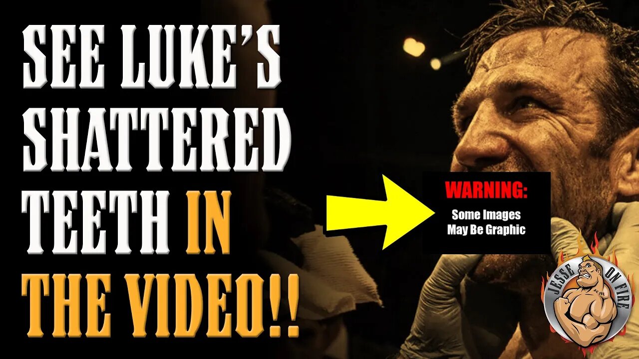 Luke Rockhold's Teeth SHATTERED by Mike Perry!! SEE THE PICS! BKFC's BREAKOUT EVENT!!
