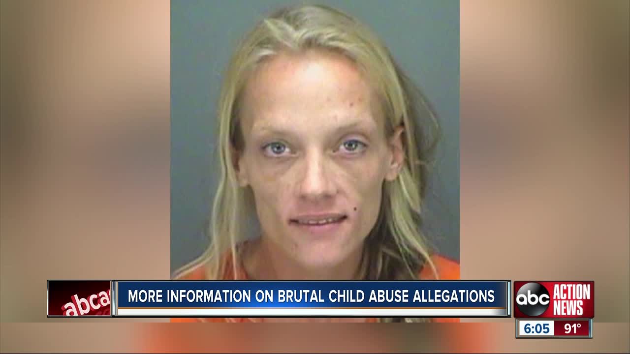 5-month-old critical after suffering severe brain bleed, mother arrested for aggravated abuse: Detectives