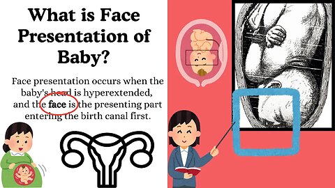 What is Face Presentation of Baby? Everything Explained for Doctors and Mothers #pregnancyeducation