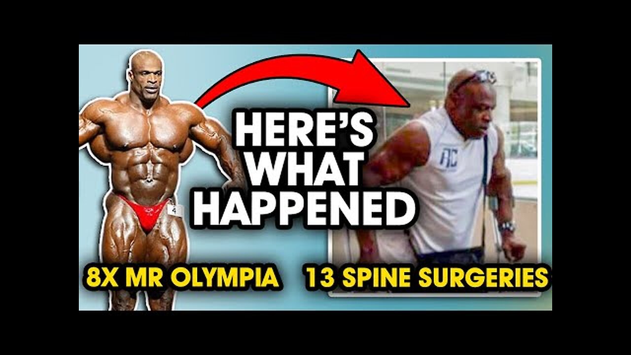 Ronnie Coleman: Mr. 8x Olympia to 13 Spine Sugeries. Here s what happened...